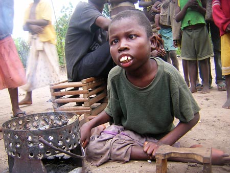 "Judith, colpita dal Konzo, e` uno dei casi piu' gravi" - Kahemba